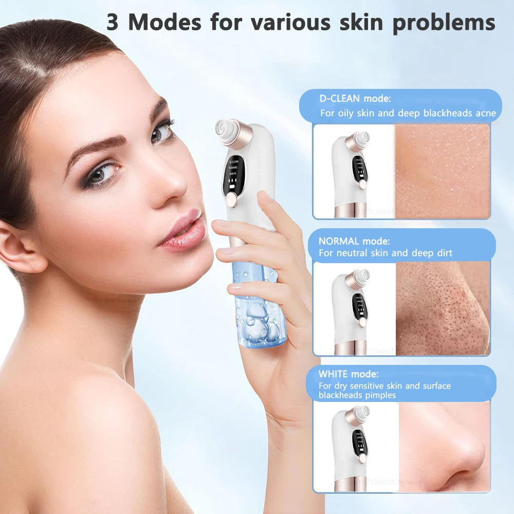 Blackhead Remover Pore Vacuum Face Nose Deep Cleaning Electric Pimple