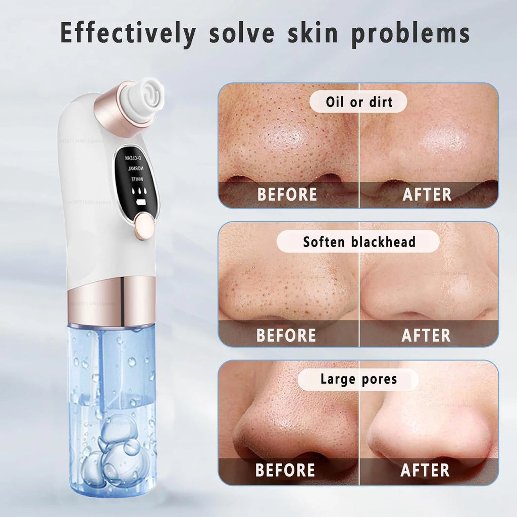 Blackhead Remover Pore Vacuum Face Nose Deep Cleaning Electric Pimple